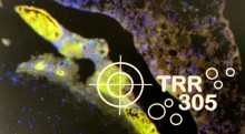 We are member of the new Transregio 305. Über die Analyse der metastatischen Koloniebildung zu neuen systemischen Krebstherapien
